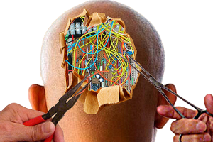 Brain Wire